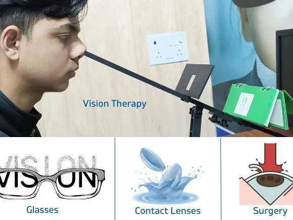 Myopia (Nearsightedness)