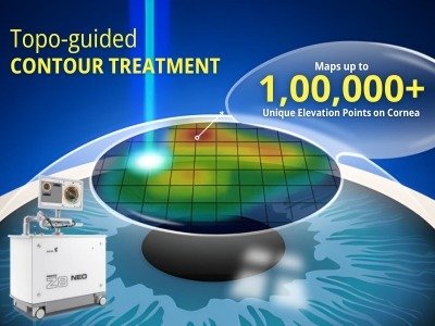 Femto LASIK | Contoura Vision
